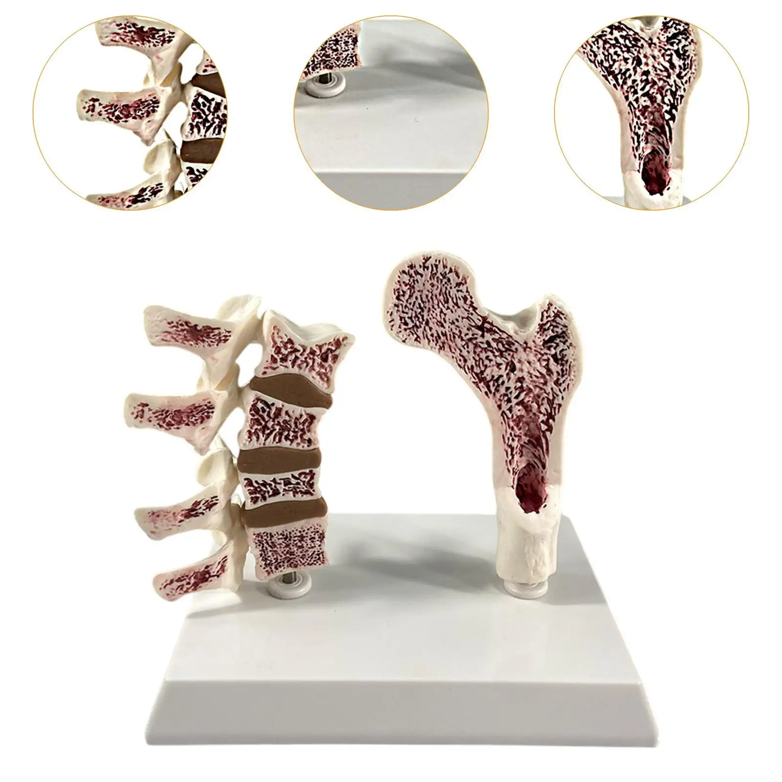 Анатомическая модель остеопорозу человекаской кости, обучающий реквизит для учебных сеансов