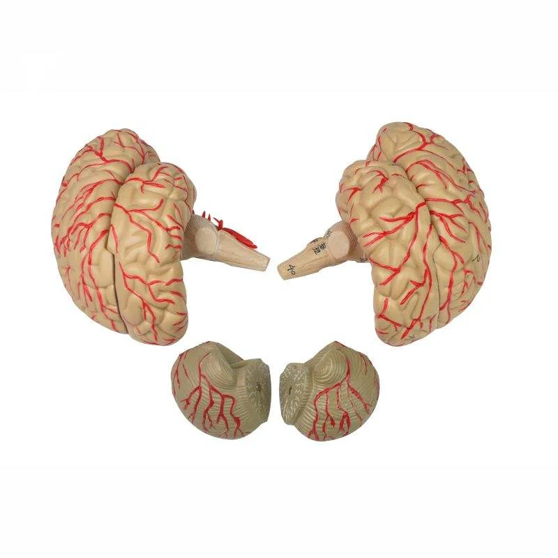 Human Brain Anatomy Model For Arterial Dissection (life-size, PVC Material)