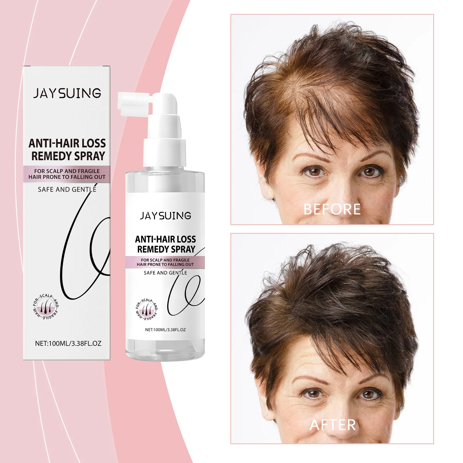 JAYSUING Anti-Hair Loss Remedy Spray Hair Loss Spray Scalp Care Hair Growth Spray