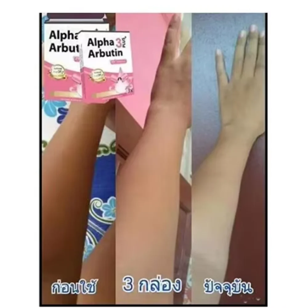 5boxes 3X Alpha Arbutin 3 Plus Powder Mix With Lotion Skin Lightening Brighten Reduce Dark Skin Blemishes