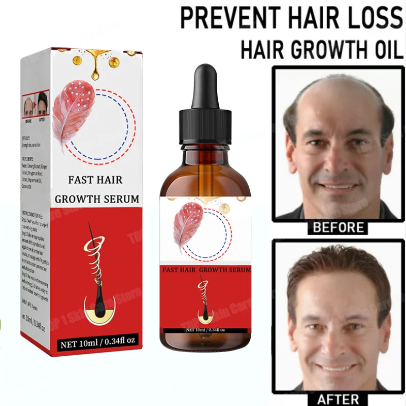 

Hairs Nourishing Care Serum, have more and more hair, say goodbye to baldness, thick hair,Hot selling product