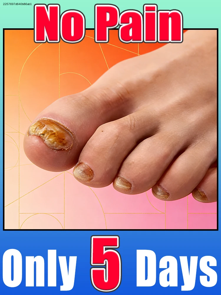 

Новая щетка для чистки ногтей 2026 года: инструмент для маникюра, хит продаж, аксессуар для ухода за ногами и нейл-арта