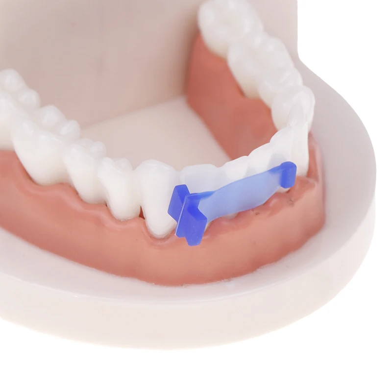 10 Uds. Matriz de mariposa Dental elasticidad tira elástica anterior y cuña materiales dentales de matriz aislante Dental