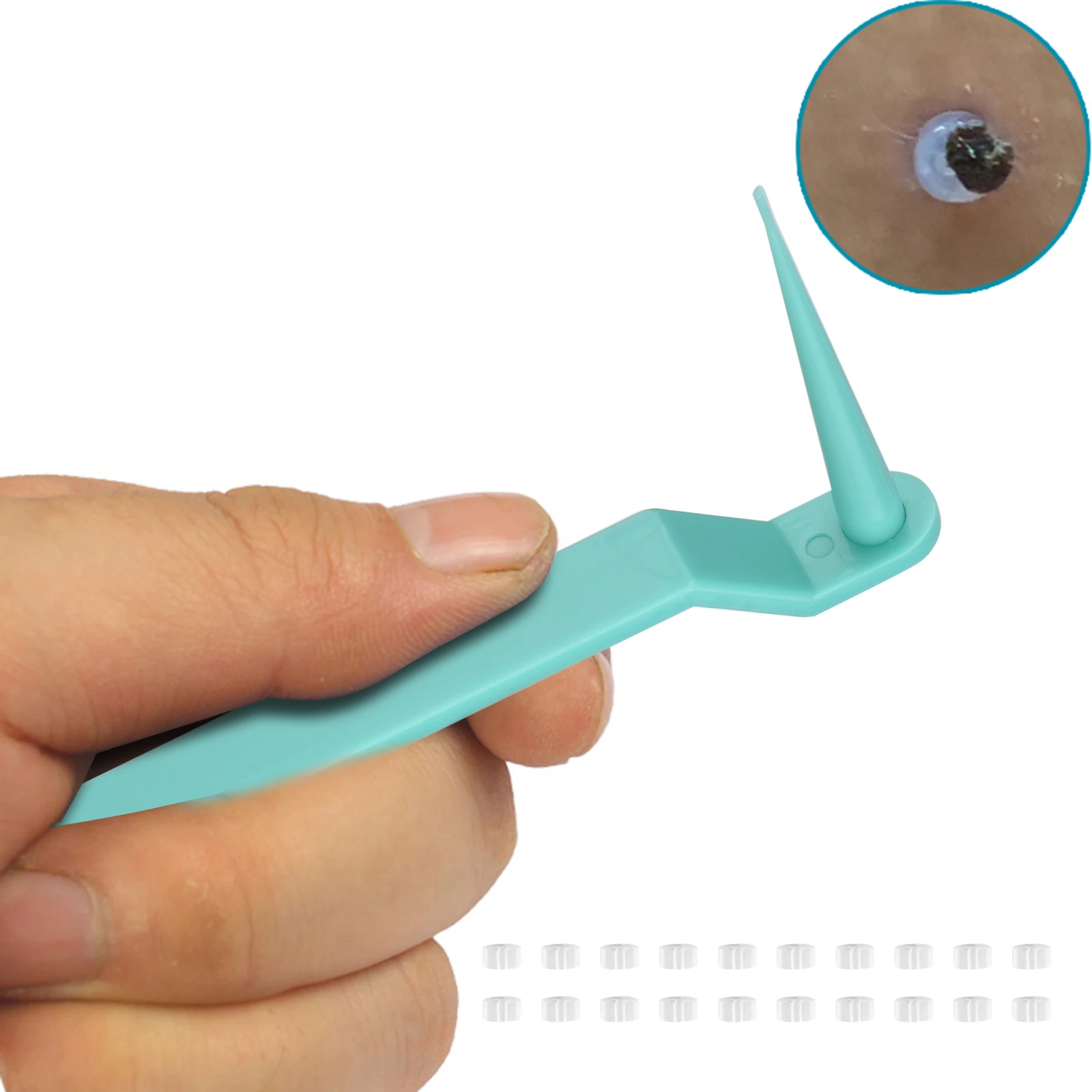 

Набор для удаления кожи для удаления кожи от маленьких до средних размеров (2–4 мм), инструмент для безболезненного удаления кожи