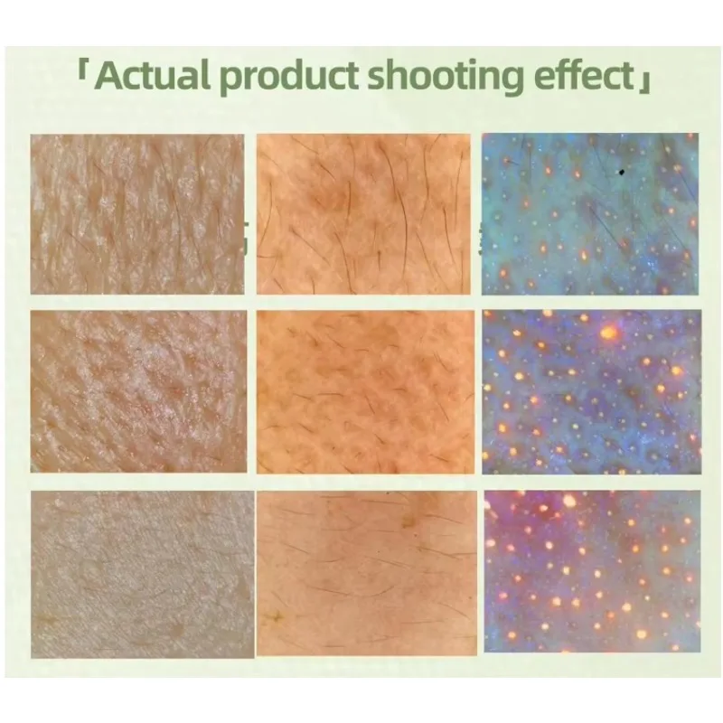 Analisador de pele que aperta o preço competitivo Analisador de pele profissional Bom preço Analisador de pele do scanner facial