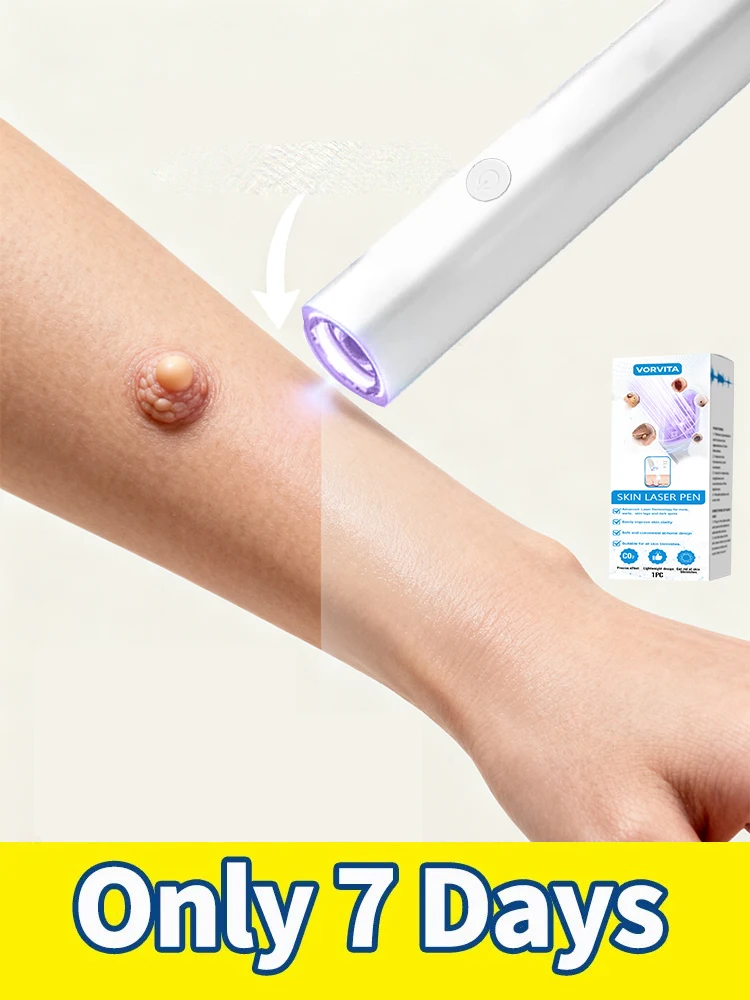 

поколение модернизированных бородавок uickly, ремонт корня бородавок SSiseur