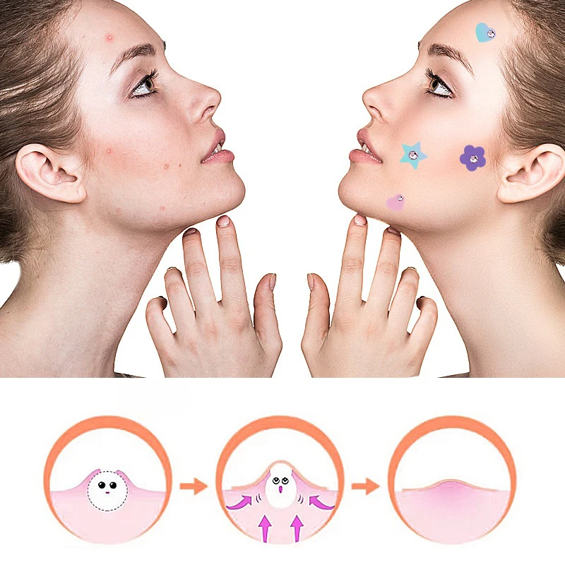 Tool Kleurrijke Acne Patch Huidverzorging Sticker Concealer Gezichtsvlek Schoonheid Make-up
