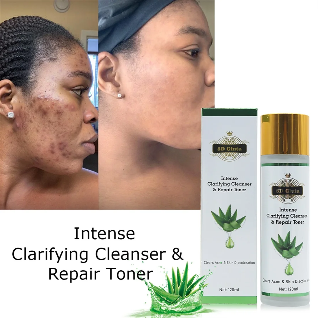 

5D Gluta Aloe Vera Repairing Moisturising Toner Anti-Acne Brightening Hydrating Moisturising Natural Face Skin Care Products