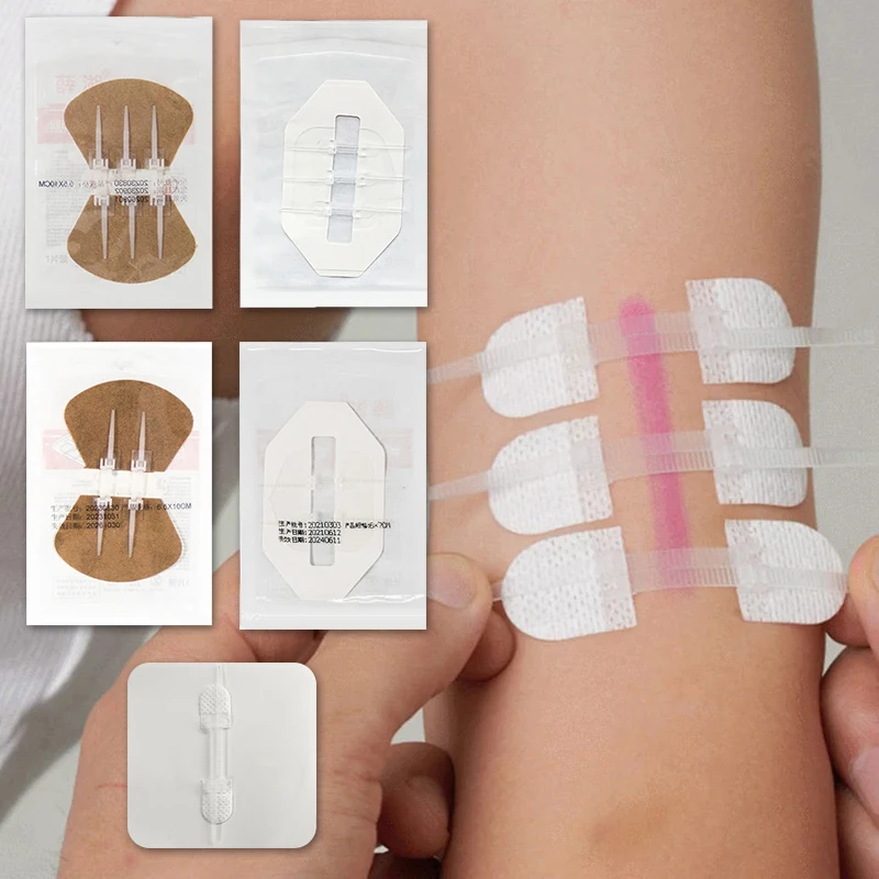Nuevo Cierre de Heridas de Emergencia con Cierre de Sujeción, Suturas, Tiritas para Reparar Heridas sin Agujas para Actividades al Aire Libre, Cierre Rápido de Heridas