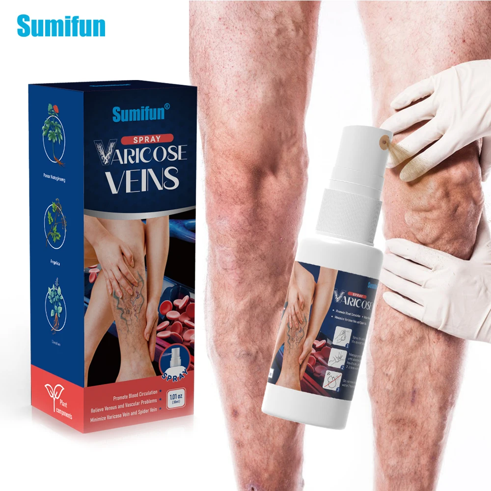 

1/2/3Pcs Sumifun Varicose Vein Spray Vasculitis Phlebitis Treatment Cream Varicosity Angiitis Legs Spider Pain Relief Plaster