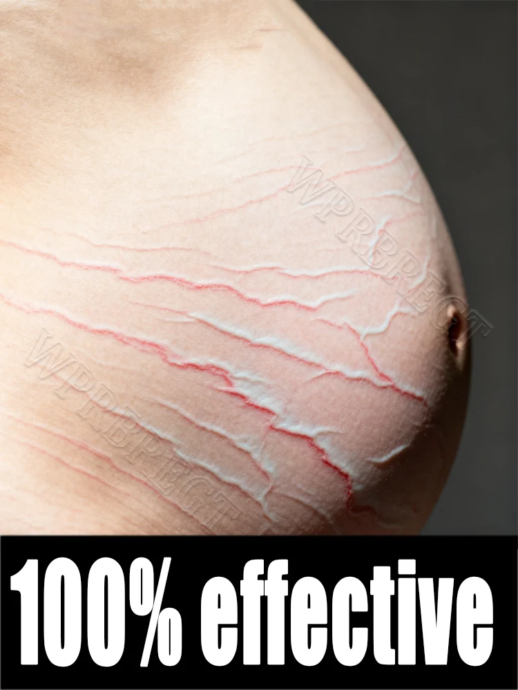 

Помощь ремонт трещин живота