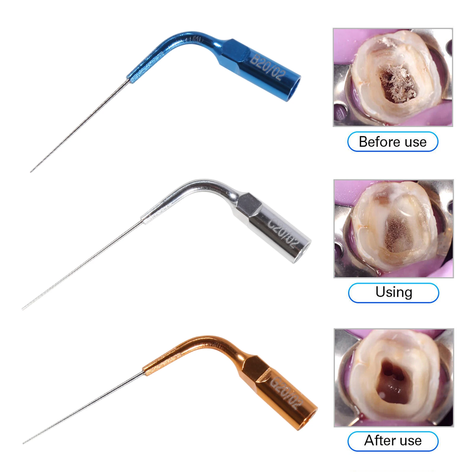 Ponta de liga de titânio para Dental Endo, Ultra Activator, ultra-sônico LED Irrigador, Canal Raiz Handpiece, Scaling, C20, G20, B20, 3pcs