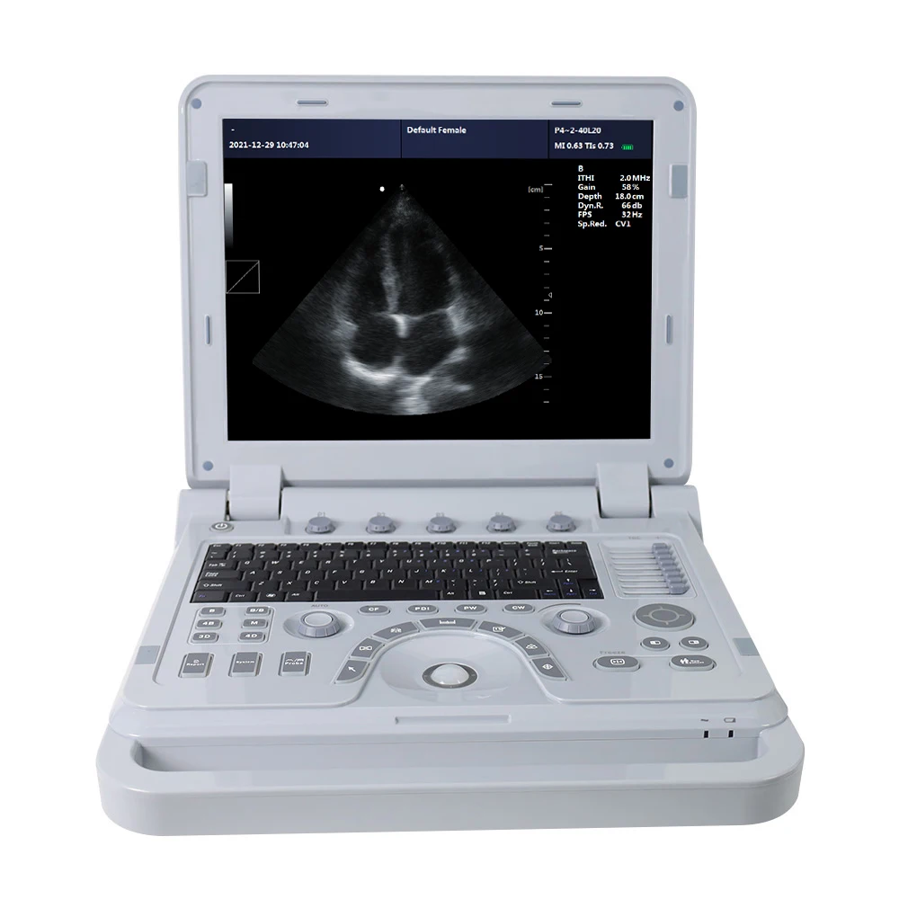 CONTEC CMS1700A-VET 3D Color Doppler Machine ultradźwiękowy portatil