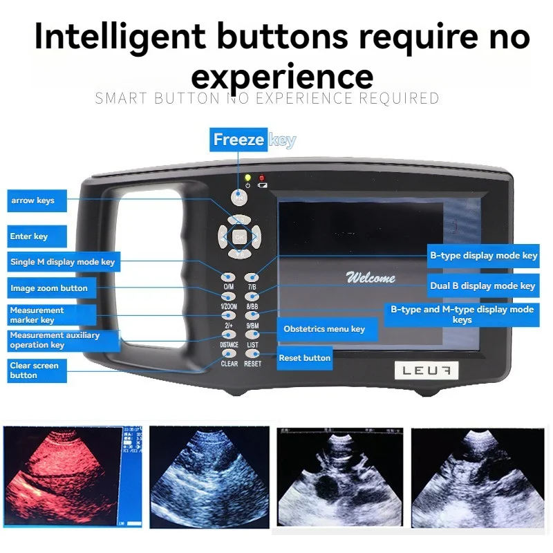 

Portable Veterinary Ultrasound Scanner Cow Pig Horse Ultrasound Pregnancy Testing Machine Veterinary Ultrasound Machine