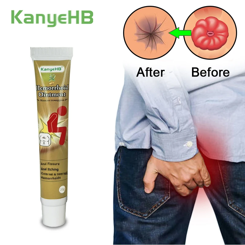 Medical Hemorrhoid Ointment Relieve Hemorrhoid Pain Anal Bleeding Swelling Anal Fissure Hemorrhoids Bacteriostatic Cream G003