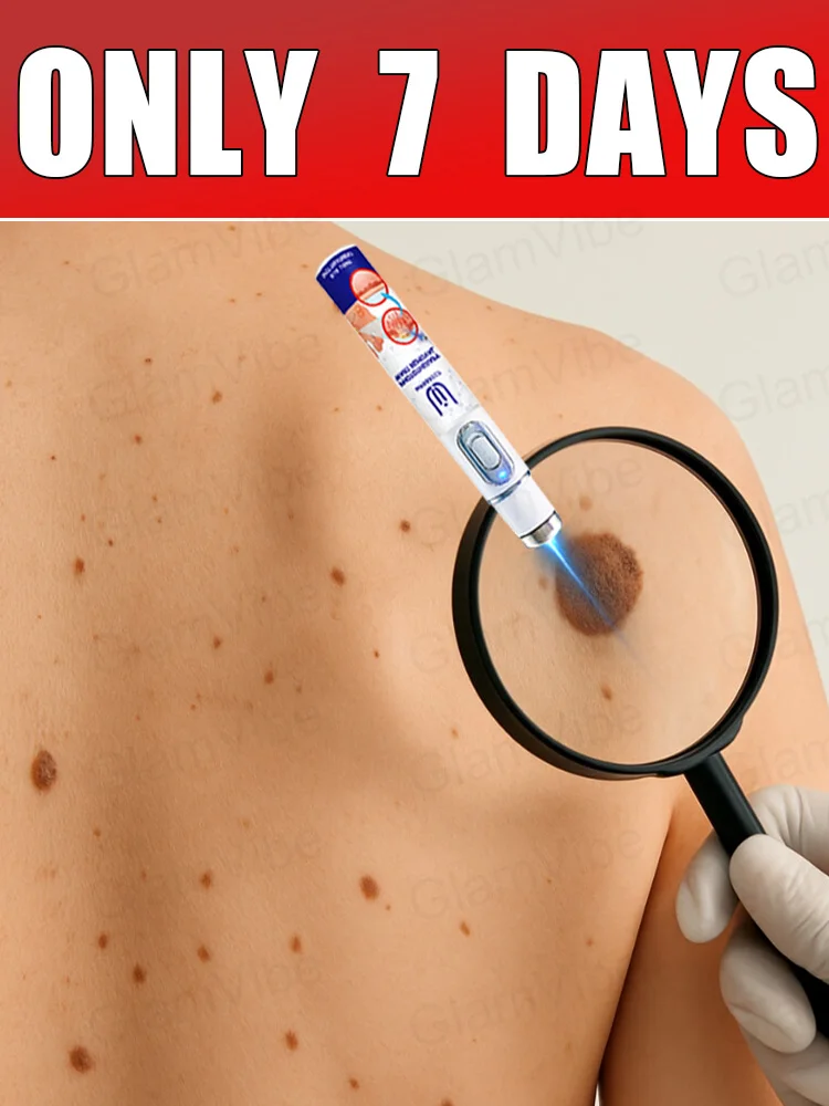 

blue light pen solve warts, hot sale wart care tools