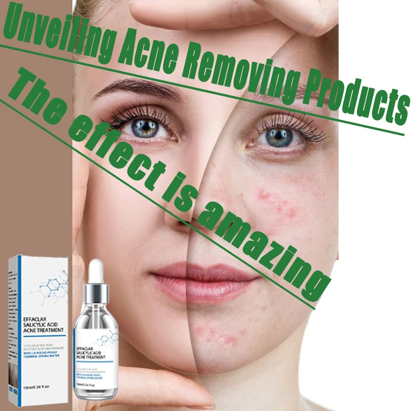 

Anti acne facial essence, acne removing and smoothing skin, collagen protein, hyaluronic acid essence oil, skin care cosmetics