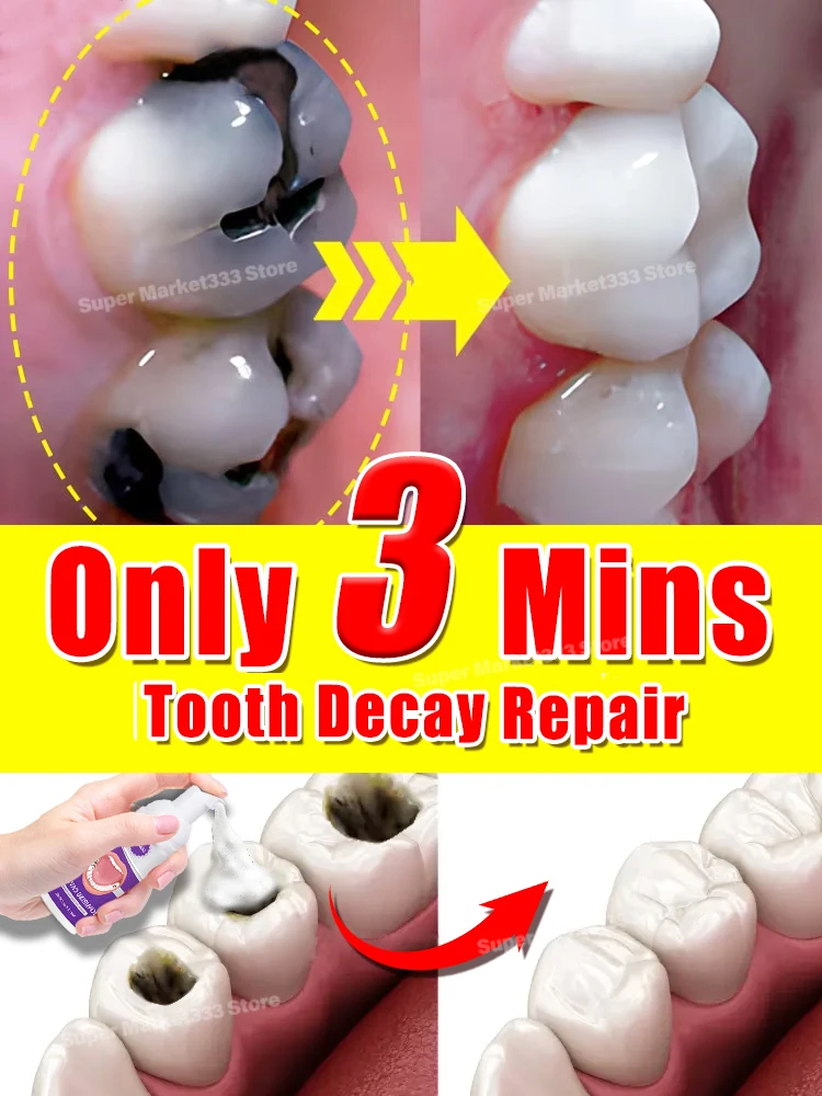 Solve all dental problem tooth decay repair tooth repair fast teeth whitening clean teeth teeth repair cavities