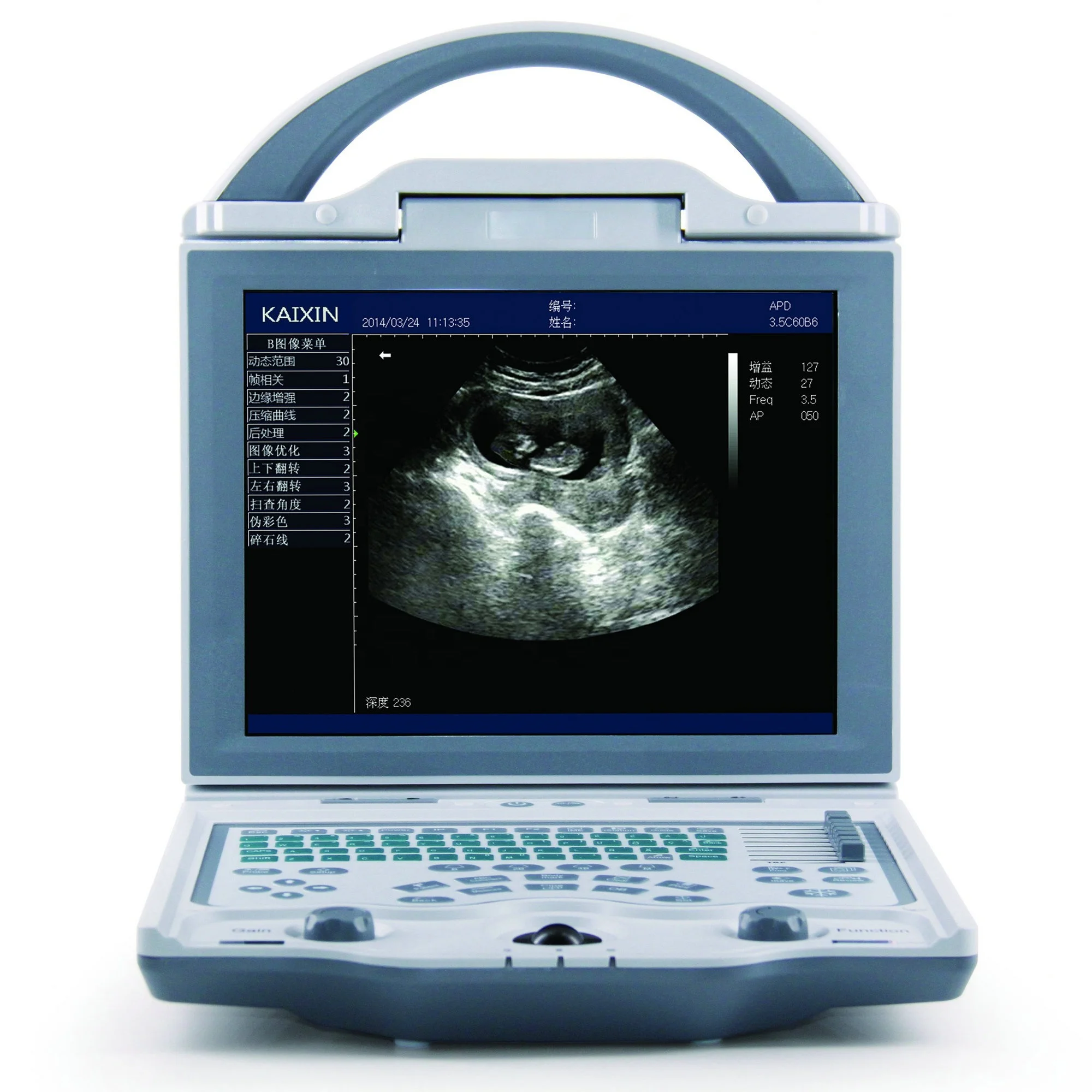 veterinary equipment veterinary pet ultrasound vet kx vet ultrasound kaixin 5600