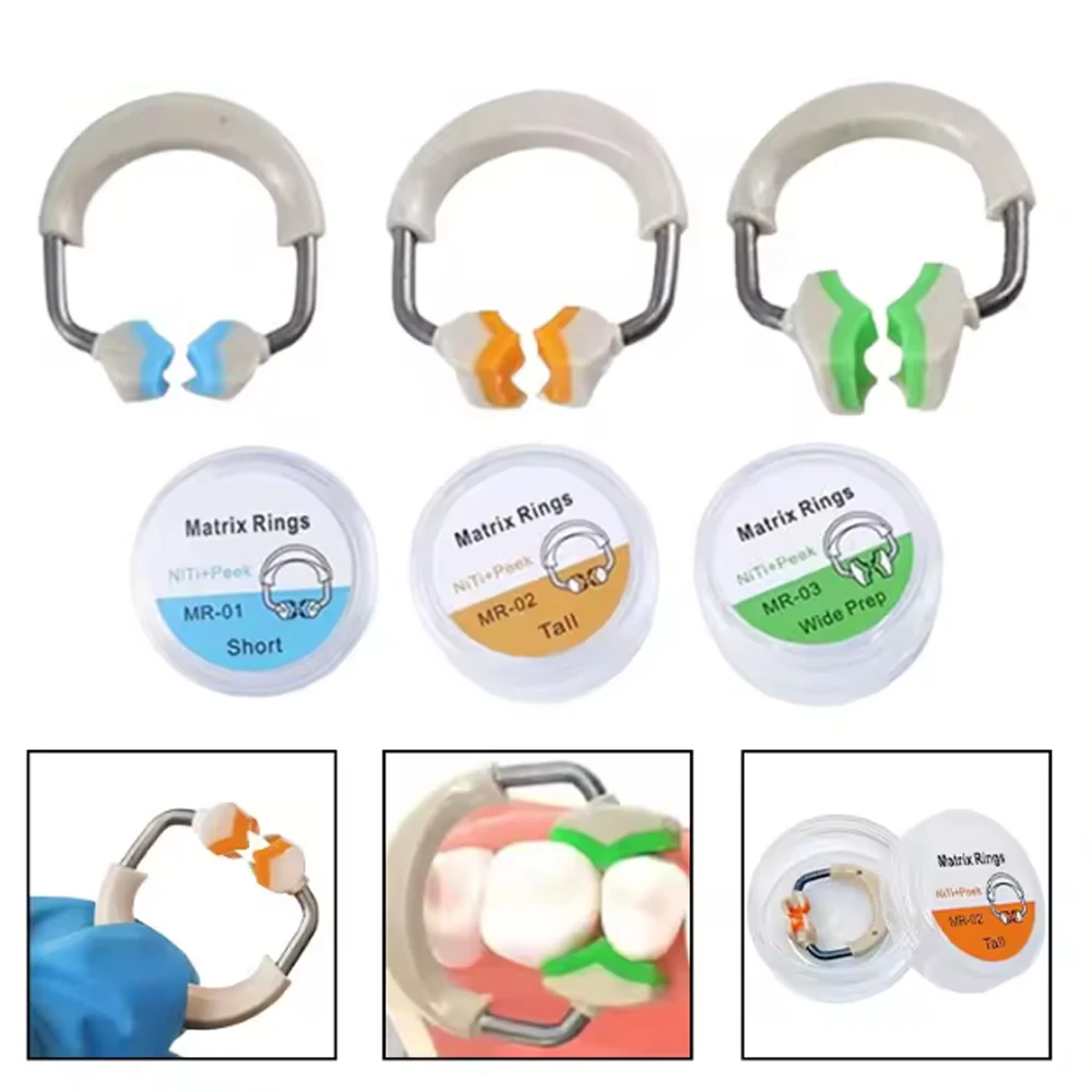 Dental Restorative Sectional Matrix System - Nitinol Niti Bands with Clip Ring for Posterior Teeth