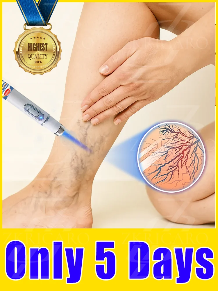 

Vᴀʀɪᴄᴏsᴇ ᴠᴇɪɴ ʟᴀsᴇʀ ɪɴsᴛʀᴜᴍᴇɴᴛ