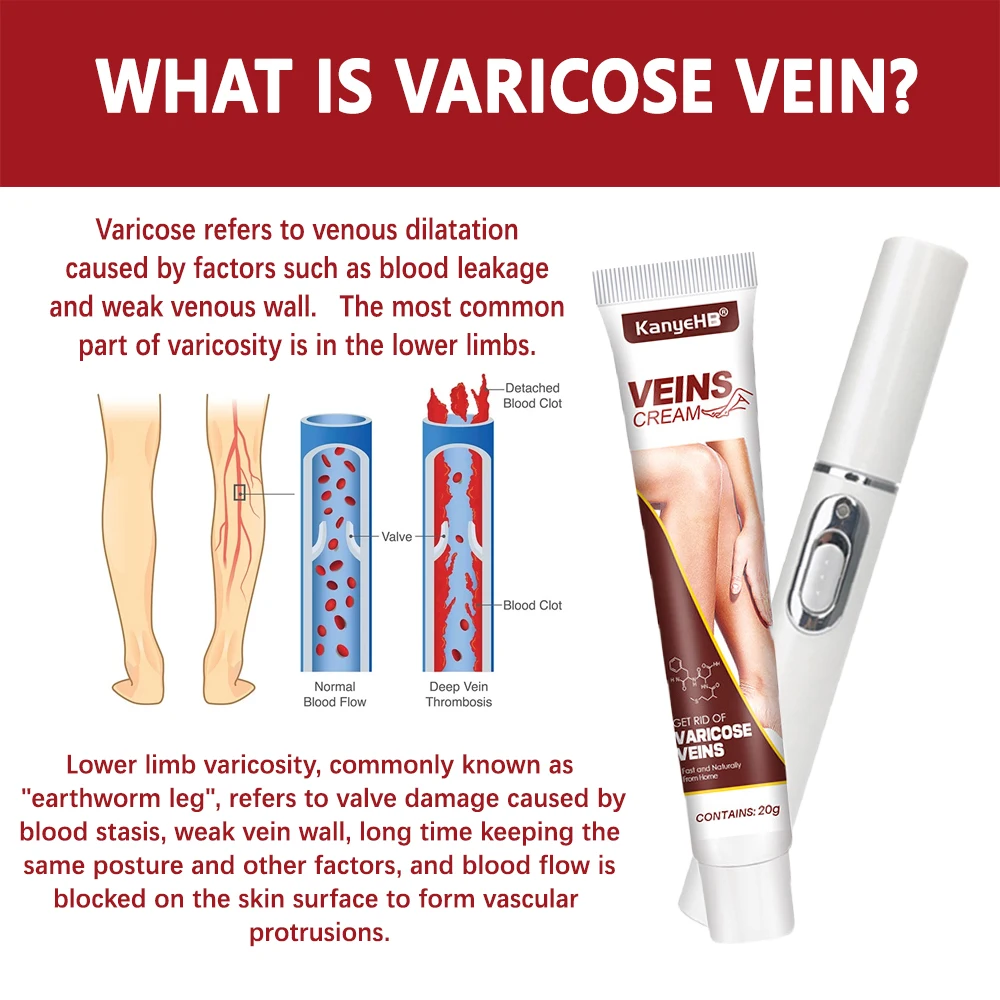 1-5pcs Varicose Veins Laser Pen Effective Eliminate Vasculitis Phlebitis Varicose Relieves Leg Bulge Pain Varicose Vein Cream