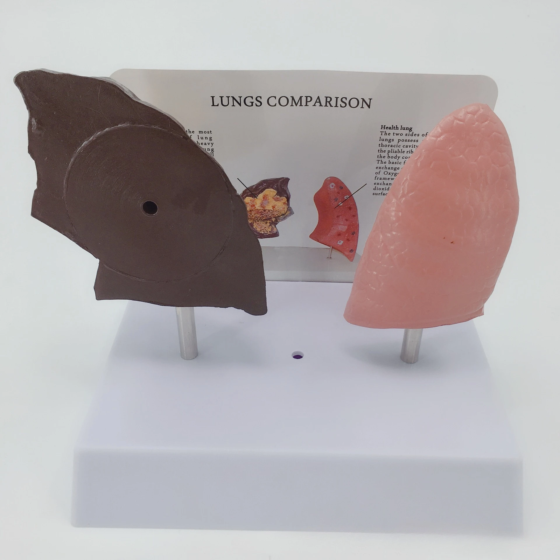 Comparative model of healthy lung and pathological lung, comparison of normal pathological lung