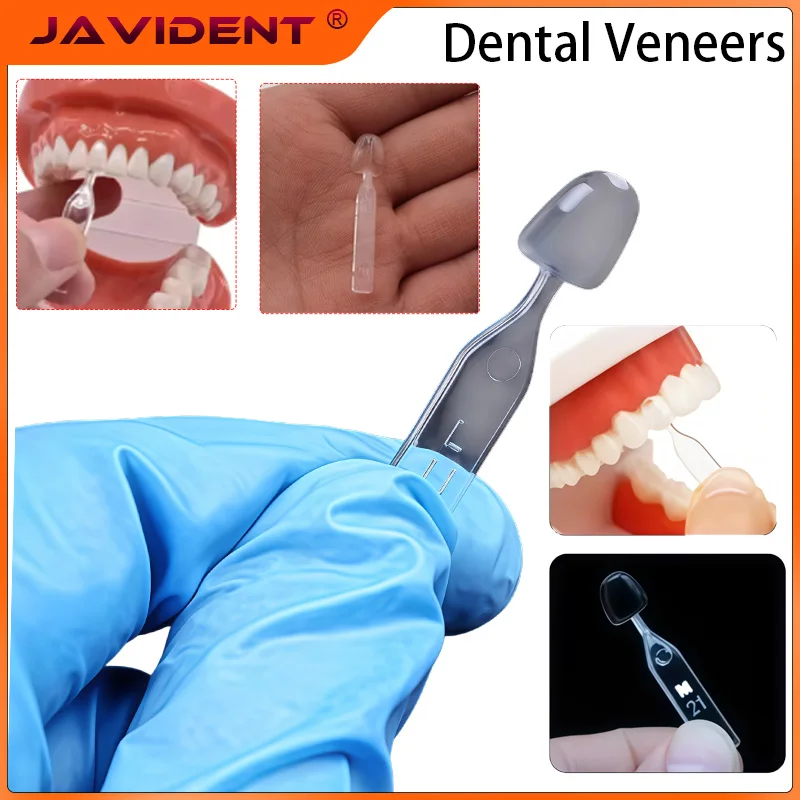 Dental Mould for Composite Resin Veneers Light Cure Filling Anterior Fast Quick Filling for Anterior Front Teeth Teeth Whitening