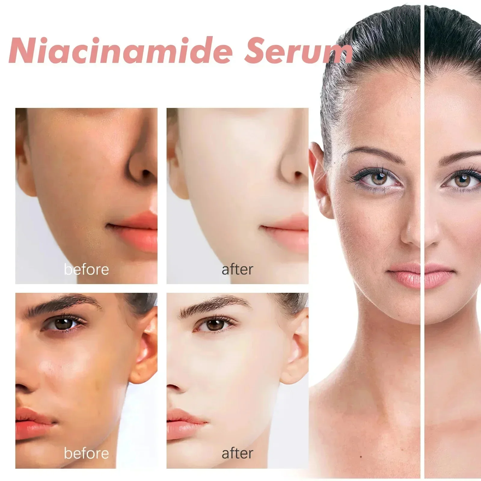 Niacinamida blanqueamiento pecas suero eliminación Melasma manchas oscuras aclara la melanina pigmentación brillo cuidado de belleza antienvejecimiento