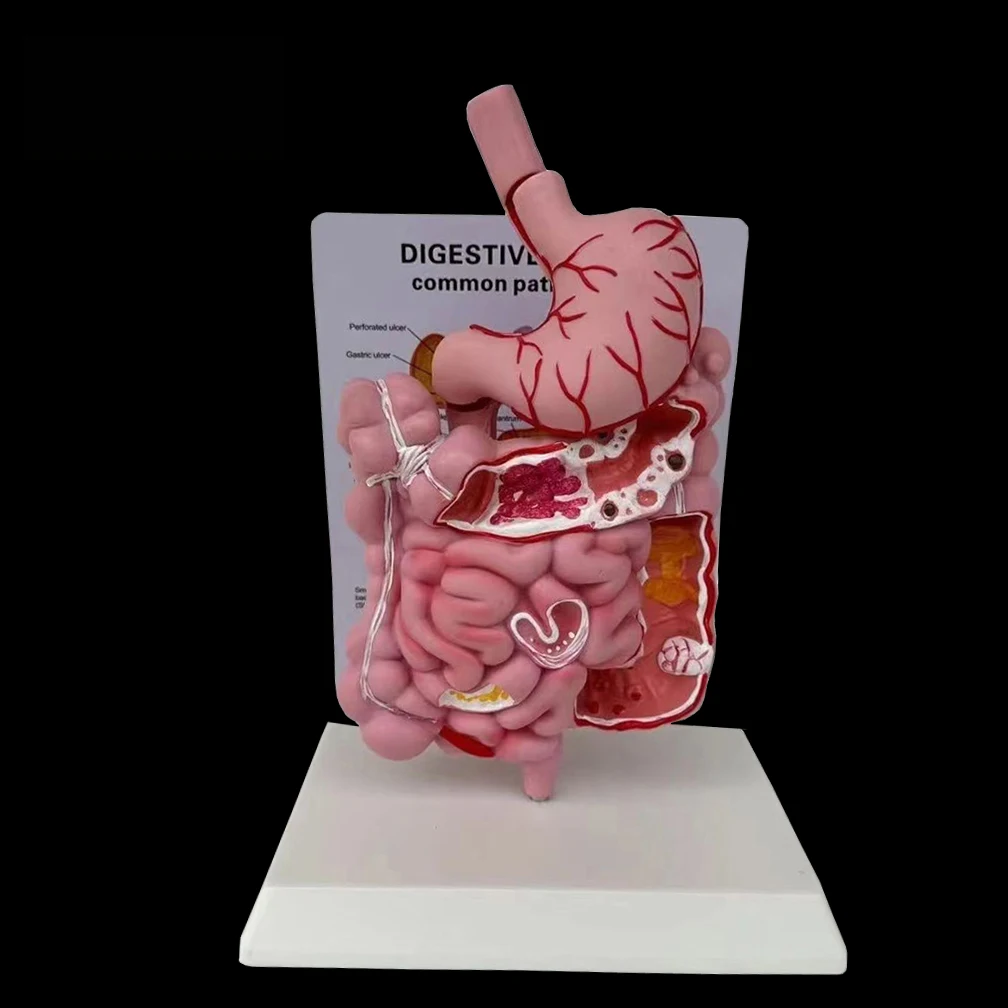 

Human Digestive System Model Stomach Anatomy Large Intestine Cecum Rectum Duodenum Human Internal Organs Structure Model ﻿