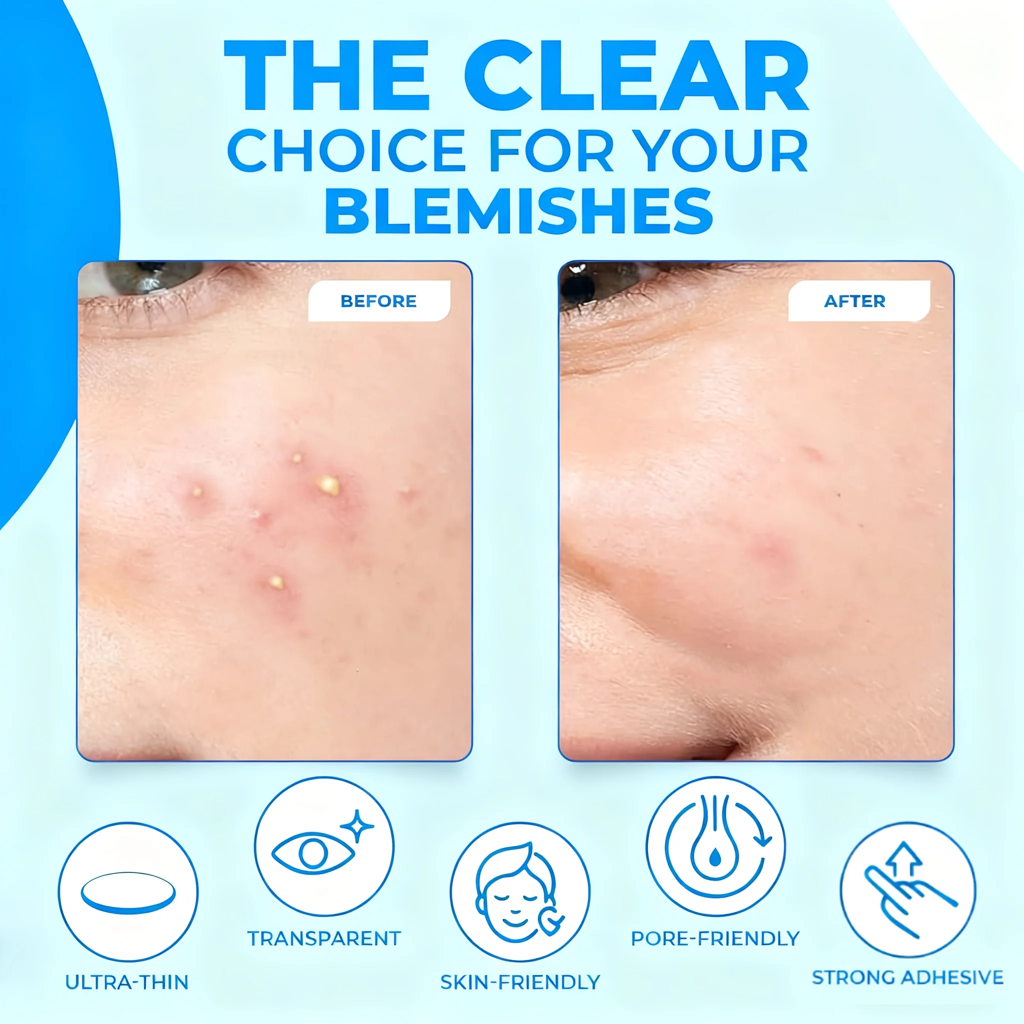 360 قطعة من رقع حب الشباب الغروانية المائية، لطيفة وغير مهيجة، خالية من الكحول وخالية من العطور، سهلة الحمل أثناء السفر.