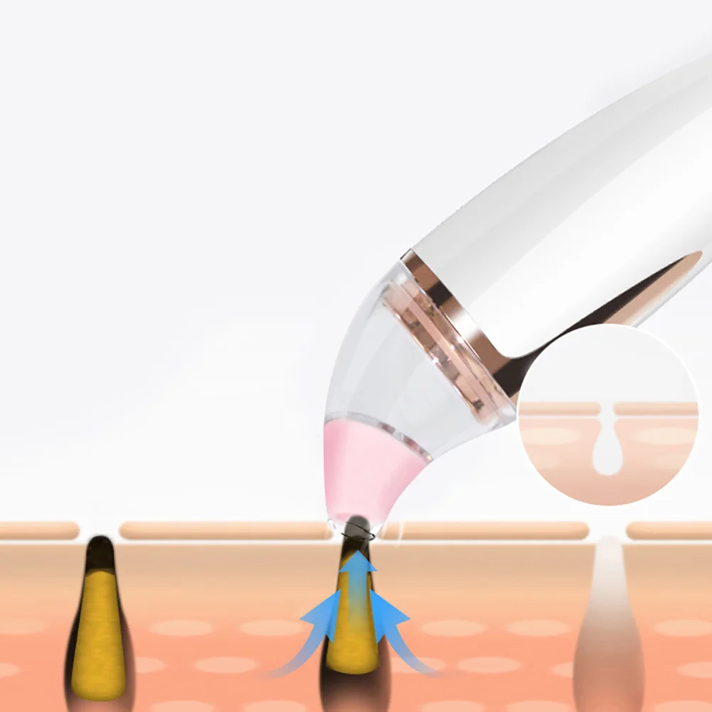 Mee-eter Instrument Gezichtsverzorging Instrumenten Reinigingsmachine Verwijderaars Verwijderen Gereedschap