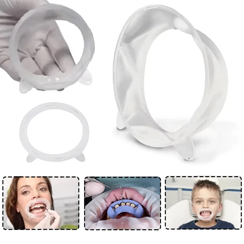 Dental Mouth Opener 3D Lip Cheek Retractor O Shape Rubber Expander for Oral Examination and Treatment Procedures
