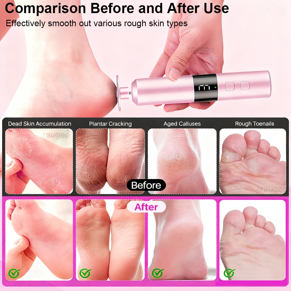 Electric Foot Callus Grinder Rechargeable Foot Predicure Grinding Machine Professional Foot File Sander Heels Dead Skin Remover image 6