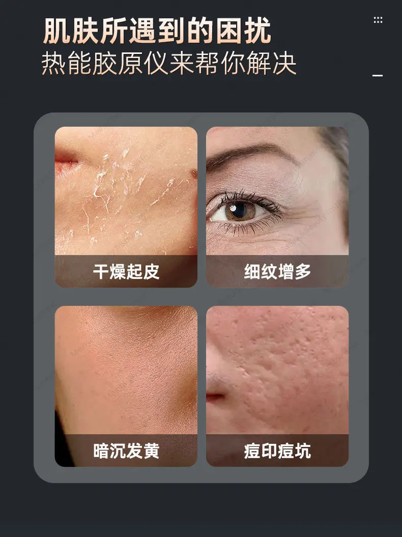 Collagen Surfer Non Invasive Collagen Water Light Beauty Device Facial Introduction Device Fine Carving Device