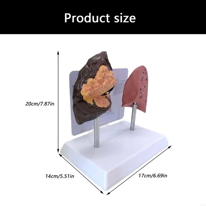 نفخة الرئة مقابل الرئة الصحية نموذج مقارن للتعليم السريري أداة تعليمية هيكل PVC الدائم F19E