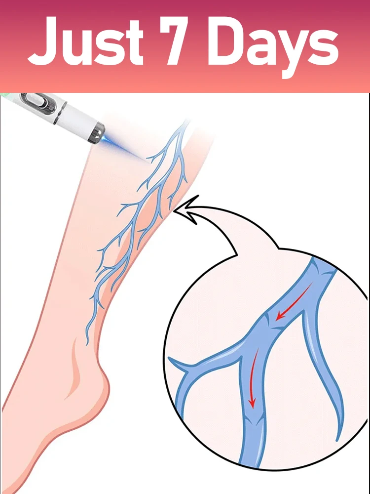 

Highly praised second-generation blue light device: effectively restores leg health.