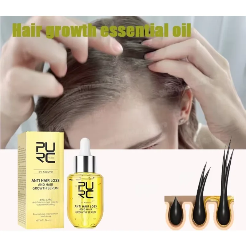 

Ginger Hair Care Oil for Men and Women to Prevent Postpartum Hair Loss and Scalp Care Essence Products