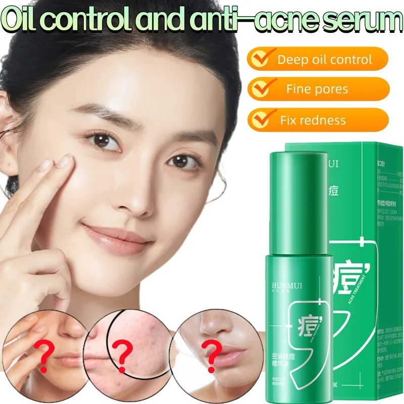 

Powerful Oil Control and Fine Pore Essence, Deep Repair Sensitive Redness Smoothing Skin Essence