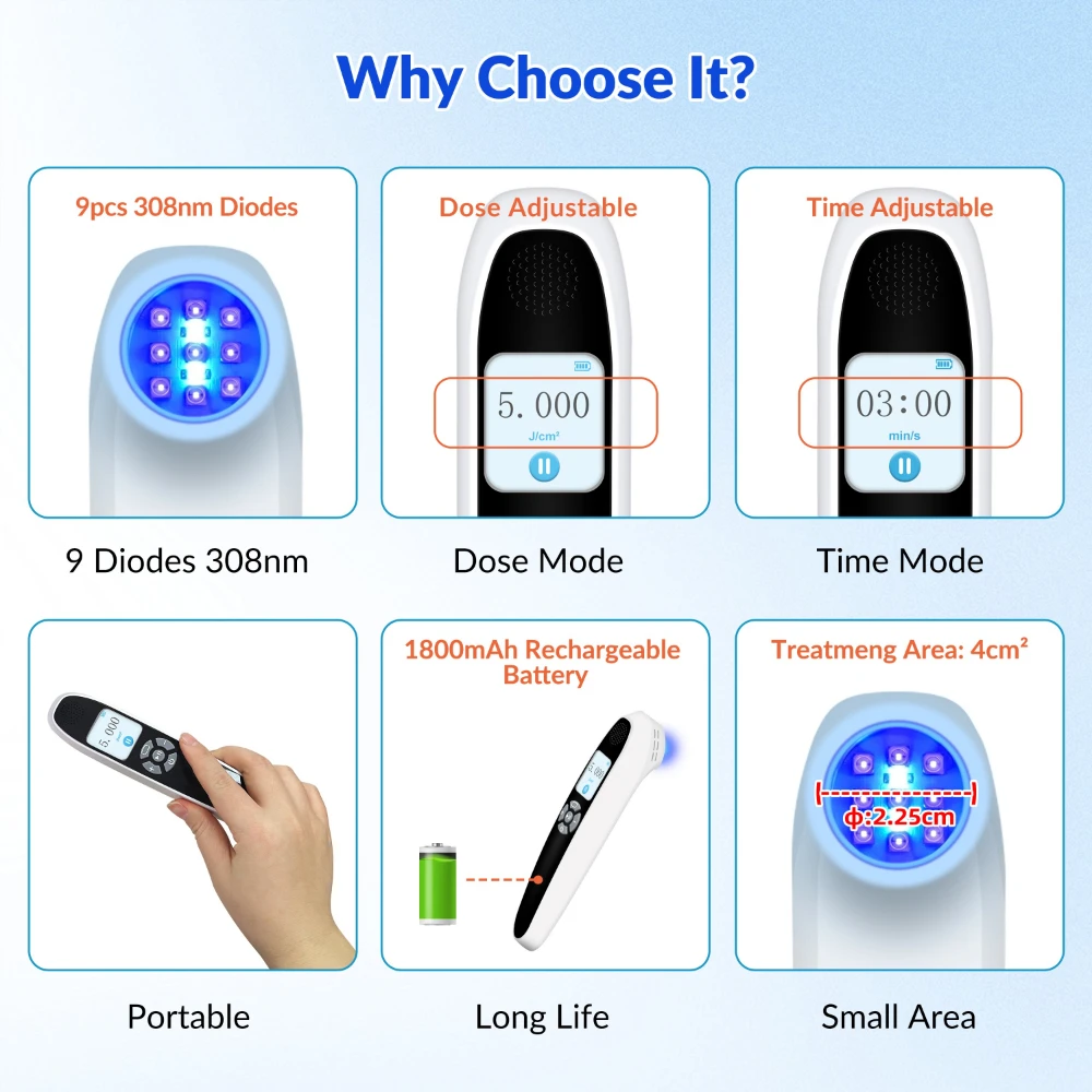 ZJZK 308nm UVB Excimer Phototherapy Laser Instrument for Shoulder Skin White Spots Lip White Patches Throat Posterior White Mark