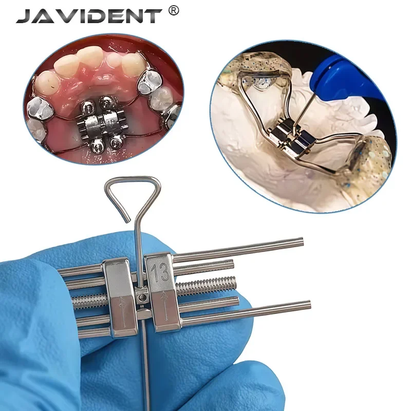 Dental Expansion Screw Ortho Expander Swivel Keys Rapid Palatal For Frame Material Tools Mini Standard 8/ 9 /11/13mm Orthodontic