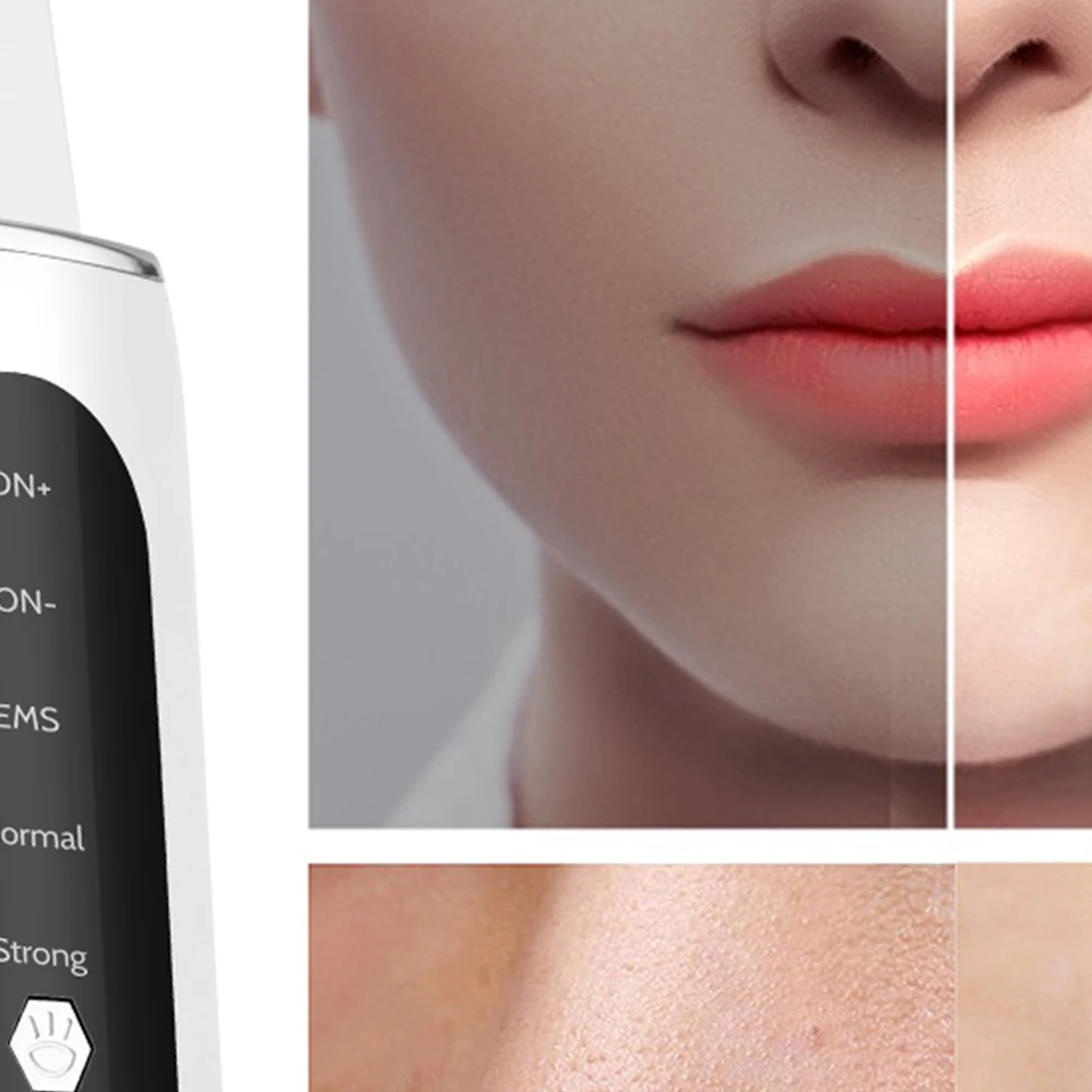 초음파 피부 스크러버 블랙헤드 제거기 모공 클리너 페이셜 셔블 클렌저 리프팅 스킨 케어 도구 페이셜 딥 클린