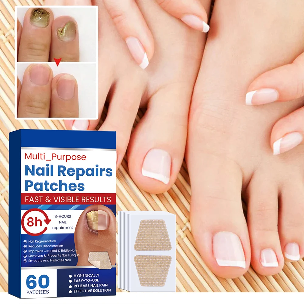 

60/180Pcs Toenail Fungus Patch Waterproof Nail Repair Patches Nail Ingrown Correction Stickers for Discolored Or Damaged Nails