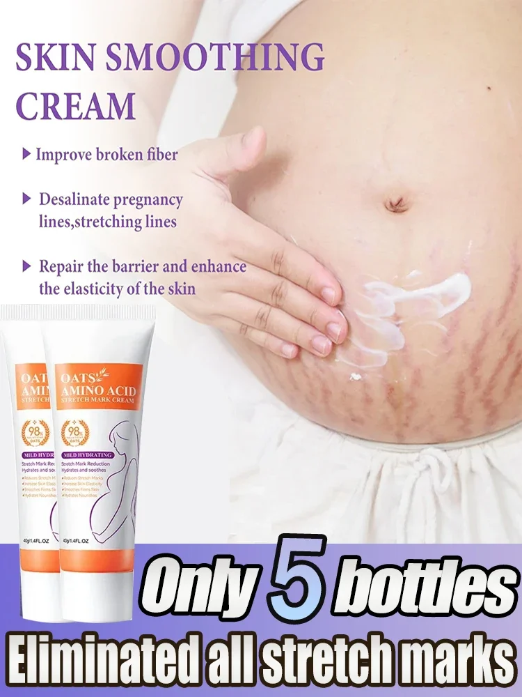 Stretch Mark Removal Cream Removes Stretch Marks Permanently Anti-Wrinkle Rejuvenates Skin