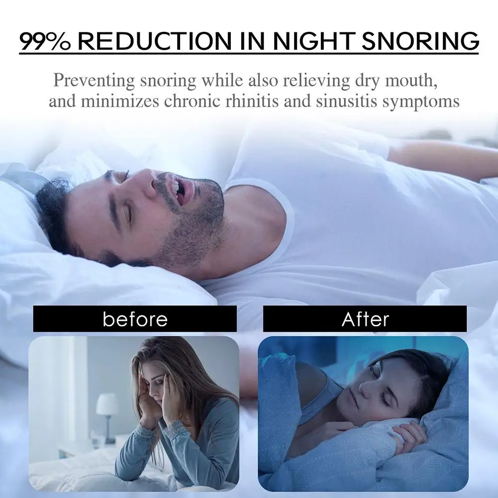 Stop Snoring Patch Nose Breathing Correction Improve Sleeping Promoting Better Breath Portable Night Sleep Mouth Orthosis Tape