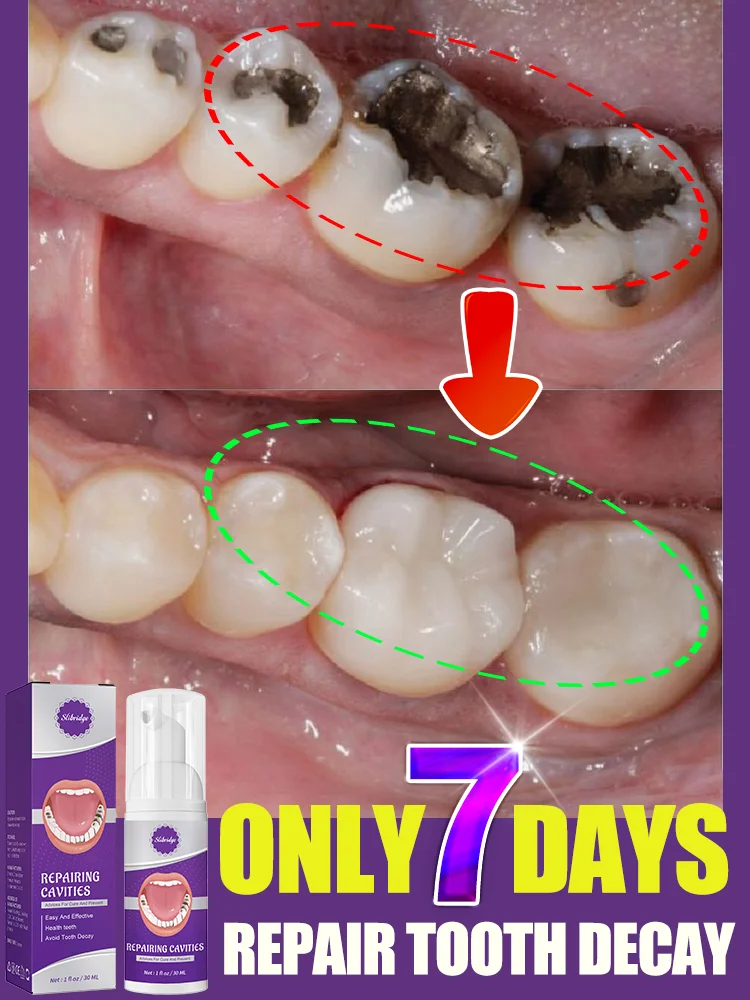 The most powerful black technology in 2024 will completely solve the problem of tooth decay!