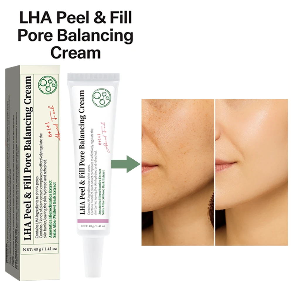 ครีม LHA Peel & Fill Pore Balancing ช่วยกระชับรูขุมขน ผลัดเซลล์ผิว และปรับผิวให้กระจ่างใส ครีมบำรุงผิวหน้าให้ความชุ่มชื้นด้วยสารสกัดจากพืช ขนาด 40 กรัม