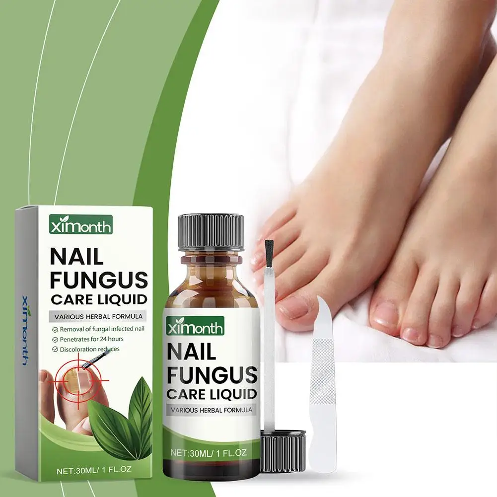 Óleo De Tratamento De Unhas Fungosas, Gel De Reparação De Fungos Do Pé, Essência Anti Essenice Remoção, Melhor Infecção Do Toe, 50g