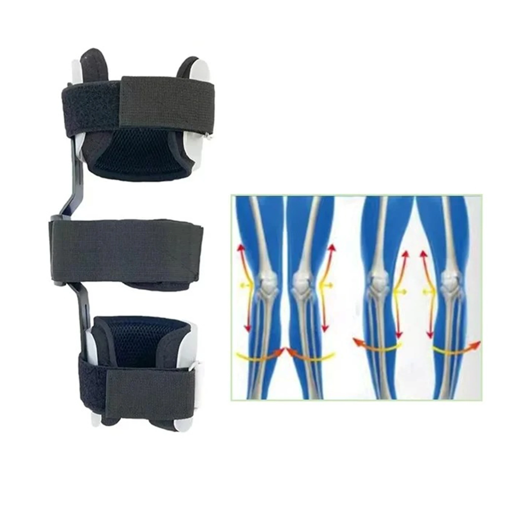 GHORTHOUD 1 Pair Kids Knock Knee Brace Children Bow Leg Correct OX Leg Orthosis Posture Corrector Brace