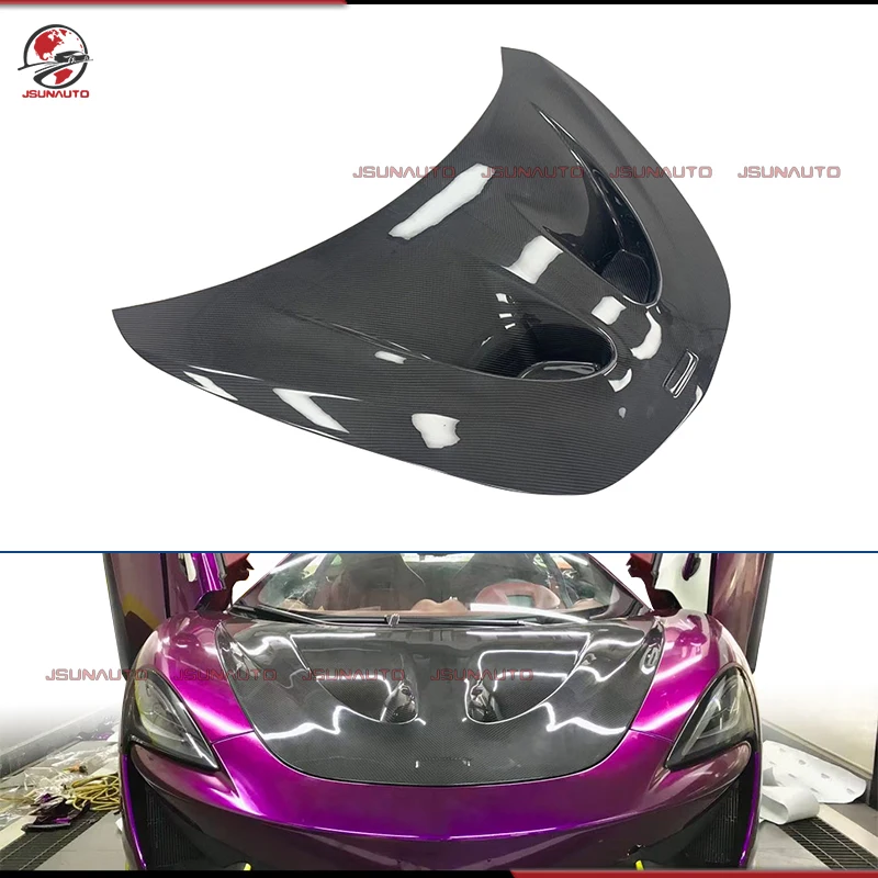 

Premium Carbon Fiber Engine Cover For McLaren 540C 570S 570GT P1 Style Front Bonnet Hood for Mclaren Bodykit Racing Modify